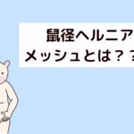 鼠径ヘルニアメッシュとは